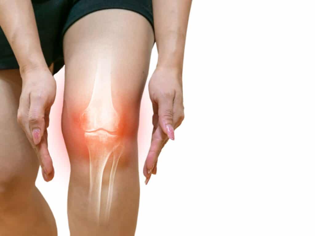 Inflammed knee joint.